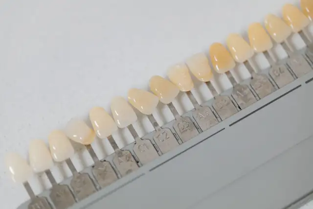 A dental shade guide with rows of porcelain tabs from bright white to warm ivory